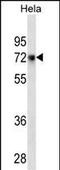 CD55 Molecule (Cromer Blood Group) antibody, M00910-1, Boster Biological Technology, Western Blot image 