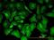 Protein Tyrosine Kinase 7 (Inactive) antibody, H00005754-M06, Novus Biologicals, Immunofluorescence image 