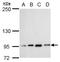Transcription Termination Factor 1 antibody, GTX129671, GeneTex, Western Blot image 