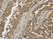 C1 esterase inhibitor antibody, CSB-PA258225, Cusabio, Immunohistochemistry paraffin image 