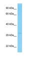 Olfactory Receptor Family 2 Subfamily T Member 12 antibody, orb327050, Biorbyt, Western Blot image 