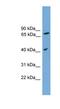 Signal Peptide Peptidase Like 3 antibody, NBP1-57070, Novus Biologicals, Western Blot image 