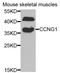 Cyclin G1 antibody, LS-C346078, Lifespan Biosciences, Western Blot image 