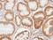 Enolase 1 antibody, GTX101803, GeneTex, Immunohistochemistry paraffin image 