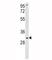 Superoxide Dismutase 3 antibody, F49928-0.4ML, NSJ Bioreagents, Western Blot image 