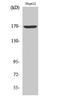 Collagen Type IV Alpha 6 Chain antibody, A06082-1, Boster Biological Technology, Western Blot image 
