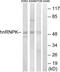 Heterogeneous Nuclear Ribonucleoprotein K antibody, LS-C117952, Lifespan Biosciences, Western Blot image 