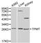 Thiopurine S-Methyltransferase antibody, PA5-37336, Invitrogen Antibodies, Western Blot image 