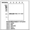 Cofilin 1 antibody, LS-B7855, Lifespan Biosciences, Western Blot image 