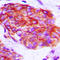 Claudin 6 antibody, LS-C354621, Lifespan Biosciences, Immunohistochemistry paraffin image 