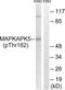 MAPK Activated Protein Kinase 5 antibody, PA5-39793, Invitrogen Antibodies, Western Blot image 