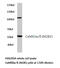 Calcium/Calmodulin Dependent Protein Kinase II Alpha antibody, AP20564PU-N, Origene, Western Blot image 