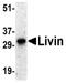 Baculoviral IAP Repeat Containing 7 antibody, PA1-31985, Invitrogen Antibodies, Western Blot image 