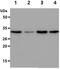 Glutathione S-Transferase Theta 2 (Gene/Pseudogene) antibody, GTX57646, GeneTex, Western Blot image 