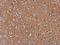 AXL Receptor Tyrosine Kinase antibody, NBP2-15530, Novus Biologicals, Immunohistochemistry paraffin image 