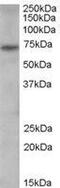 Peptidyl Arginine Deiminase 4 antibody, GTX89631, GeneTex, Western Blot image 