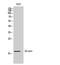 Epigen antibody, A10011, Boster Biological Technology, Western Blot image 