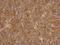 Actin Related Protein T1 antibody, LS-C155623, Lifespan Biosciences, Immunohistochemistry frozen image 