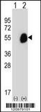 Glutaryl-CoA Dehydrogenase antibody, 56-724, ProSci, Western Blot image 