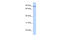 L3MBTL Histone Methyl-Lysine Binding Protein 1 antibody, 25-388, ProSci, Enzyme Linked Immunosorbent Assay image 