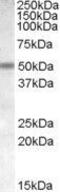 Cholinergic Receptor Nicotinic Beta 3 Subunit antibody, GTX88687, GeneTex, Western Blot image 