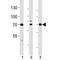 Activating Transcription Factor 6 Beta antibody, F49022-0.4ML, NSJ Bioreagents, Immunohistochemistry paraffin image 