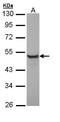 Keratin 13 antibody, LS-C186107, Lifespan Biosciences, Western Blot image 