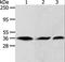 Apurinic/Apyrimidinic Endodeoxyribonuclease 1 antibody, LS-C400548, Lifespan Biosciences, Western Blot image 