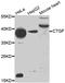 Cellular Communication Network Factor 2 antibody, MBS127727, MyBioSource, Western Blot image 
