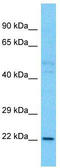 TLC Domain Containing 1 antibody, TA332169, Origene, Western Blot image 