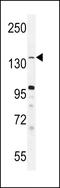 Lysine Demethylase 3B antibody, LS-C165358, Lifespan Biosciences, Western Blot image 