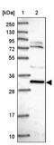 Coiled-coil domain-containing protein 106 antibody, NBP2-30390, Novus Biologicals, Western Blot image 