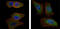 AKT Serine/Threonine Kinase 2 antibody, abx010368, Abbexa, Enzyme Linked Immunosorbent Assay image 