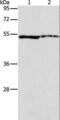 Aldehyde Dehydrogenase 3 Family Member A1 antibody, LS-C404481, Lifespan Biosciences, Western Blot image 
