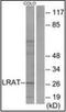 Lecithin Retinol Acyltransferase antibody, orb96496, Biorbyt, Western Blot image 
