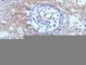 CD59 Molecule (CD59 Blood Group) antibody, V3022IHC-7ML, NSJ Bioreagents, Immunohistochemistry paraffin image 