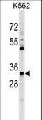 Ficolin 1 antibody, LS-C166108, Lifespan Biosciences, Western Blot image 