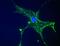 Desmin antibody, PA5-16705, Invitrogen Antibodies, Immunofluorescence image 