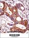 Carcinoembryonic Antigen Related Cell Adhesion Molecule 7 antibody, 58-984, ProSci, Immunohistochemistry paraffin image 