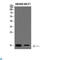 Replication Protein A3 antibody, LS-C813931, Lifespan Biosciences, Western Blot image 