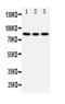 Phosphoinositide-3-Kinase Regulatory Subunit 2 antibody, PA1680, Boster Biological Technology, Western Blot image 