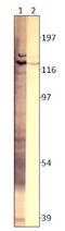 AC3 antibody, GTX14778, GeneTex, Western Blot image 