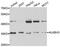 AlkB Homolog 3, Alpha-Ketoglutaratedependent Dioxygenase antibody, A06750, Boster Biological Technology, Western Blot image 