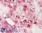 Collagen Type V Alpha 1 Chain antibody, LS-B13132, Lifespan Biosciences, Immunohistochemistry paraffin image 