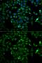 Triosephosphate Isomerase 1 antibody, GTX32936, GeneTex, Immunocytochemistry image 