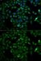 TPI antibody, GTX32936, GeneTex, Immunocytochemistry image 