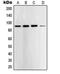 Signal Transducer And Activator Of Transcription 5A antibody, orb214622, Biorbyt, Western Blot image 