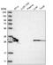 Carbonic Anhydrase 3 antibody, HPA026700, Atlas Antibodies, Western Blot image 
