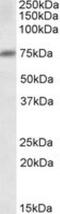 Decapping MRNA 1A antibody, NB100-2830, Novus Biologicals, Western Blot image 