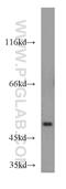 TSPY Like 1 antibody, 13932-1-AP, Proteintech Group, Western Blot image 